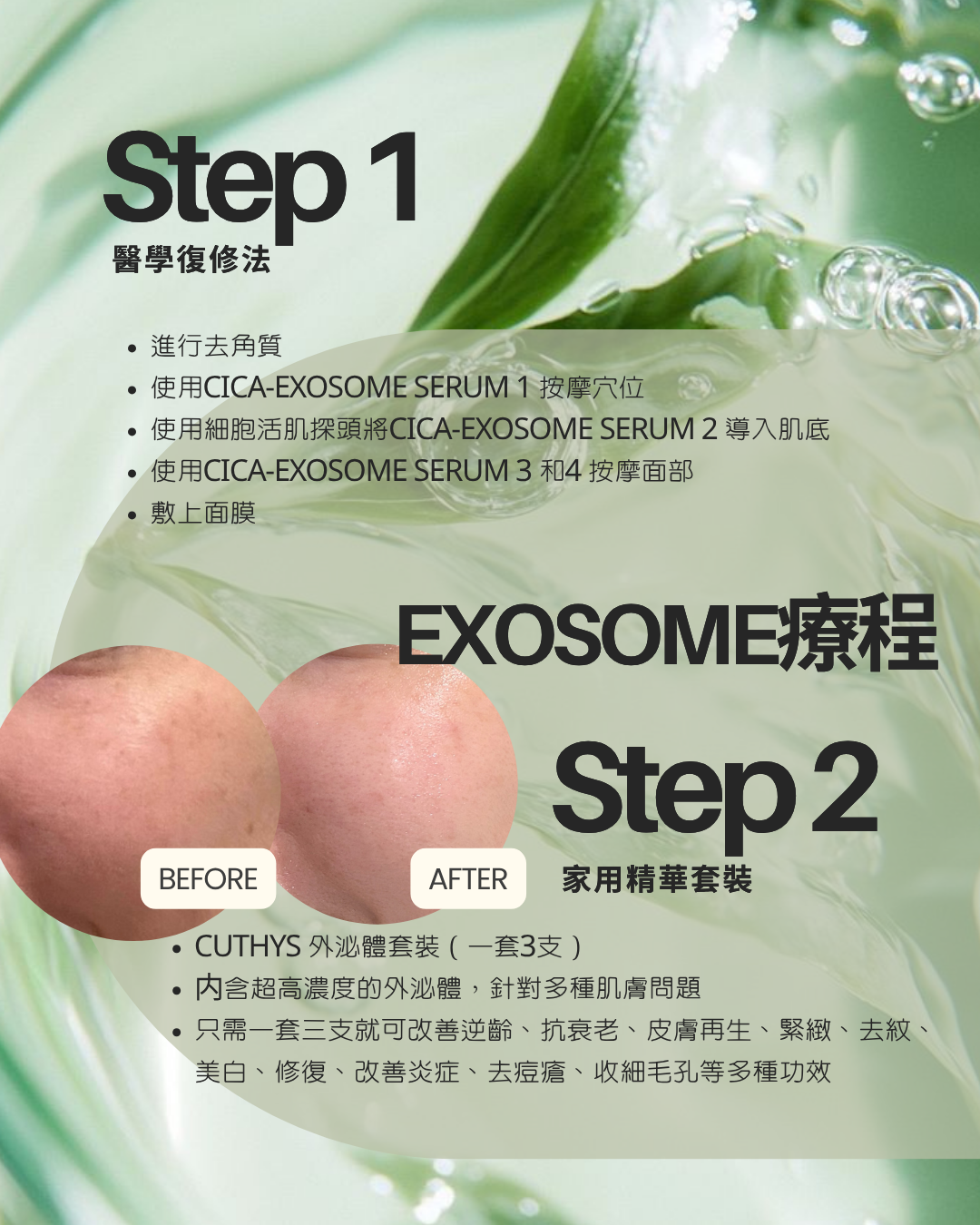 CUTHYS EXOSOME 外泌體療程