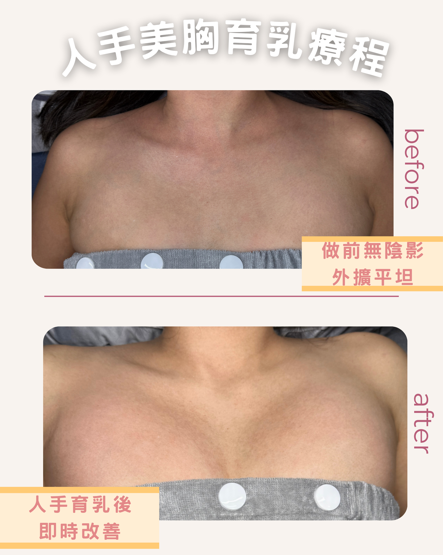 人手育乳術 （試做價 $480 20分鐘）