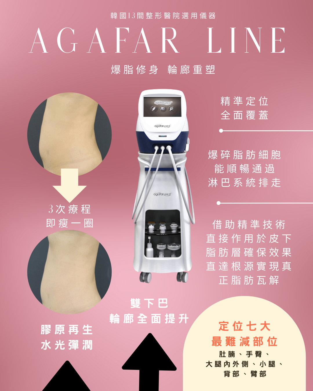 纖索爆脂膠原自生療程AGAFAR LINE 訂金